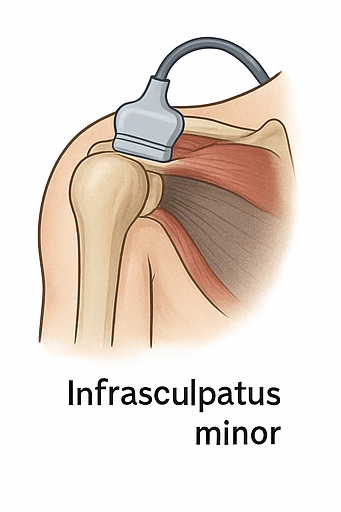 Vista posterior complementaria